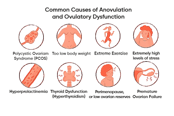 Ovulation Dysfunction